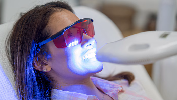 Laser Teeth Whitening